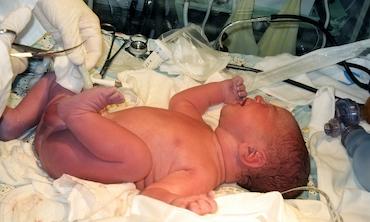 Chirurgie Néonatale